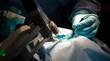 全球首款眼科手術機器人