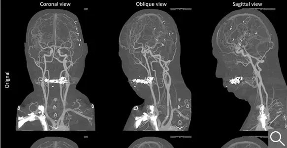 最佳人氣海報票選